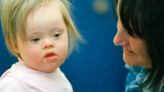 A young girl with Down's Syndrome and her mum.