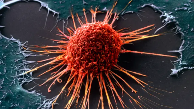 Cervical cancer cell