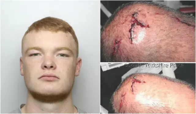 Police images of Cheetham and officer's injuries