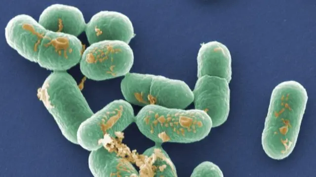 The strain of listeria found in the factory that tested positive is particularly virulent