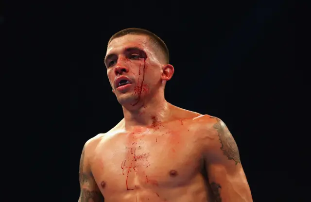 Lee Selby