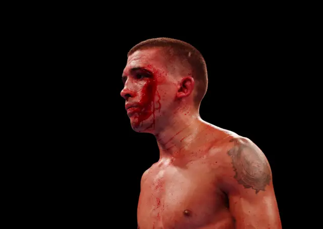 Lee Selby's cut