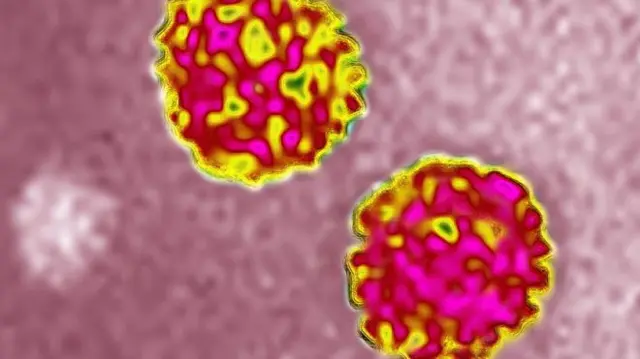 Up to 74,000 people in Scotland may be living with Hepatitis C, a disease which campaigners say is now curable