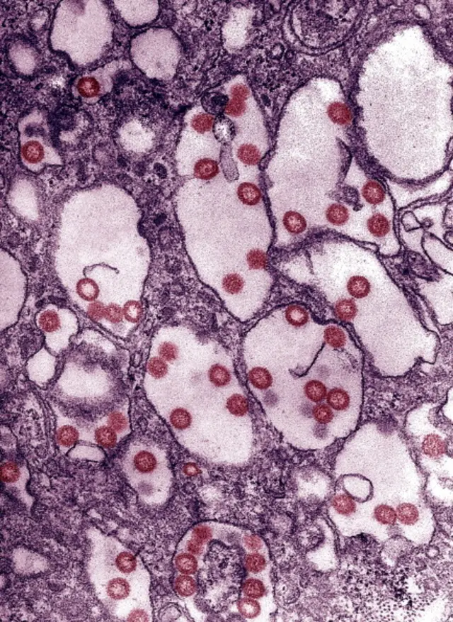 Electron Micrograph Of The Rift Valley Fever Virus.