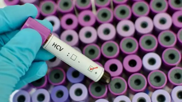 HCV  test tube with a positive tick