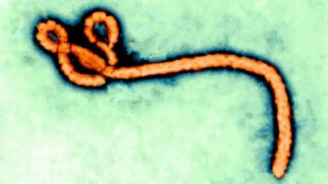 The Ebola virus seen under microscope