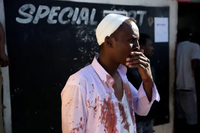 An injured Somali man outside his shop in Soweto