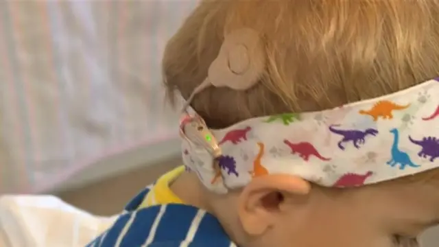 Max's cochlear implant