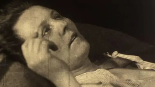 Woman suffering Spanish Flu