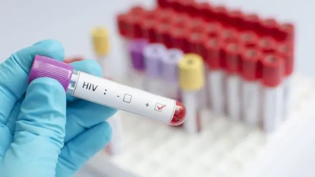 HIV blood sample