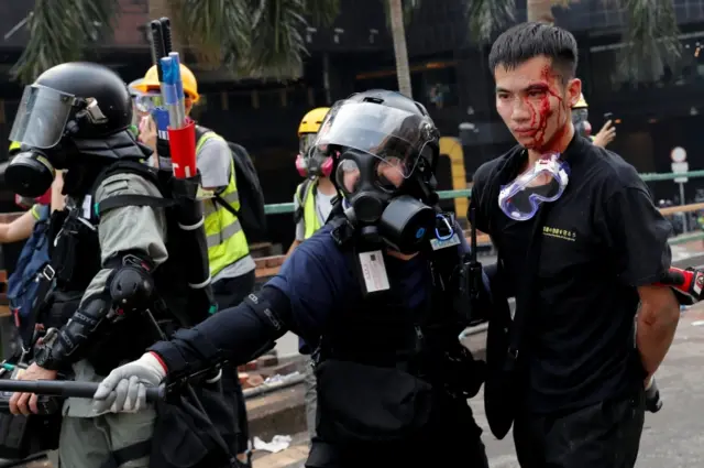 An injured protester is held by the police at the PolyU campus