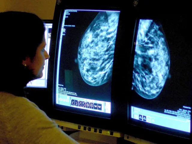 A  consultant analyzing a mammogram.