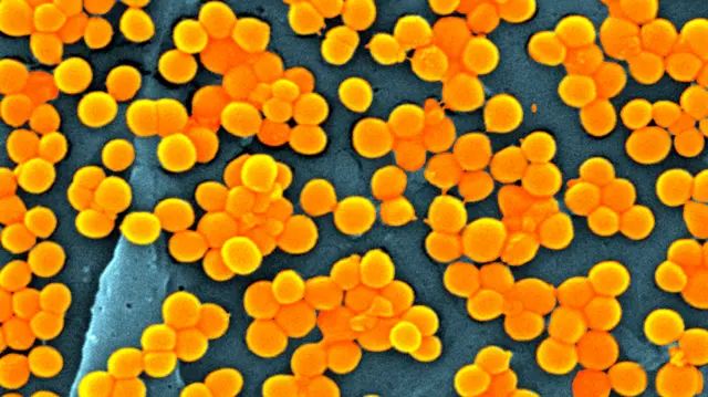 Staphylococcus MRSA