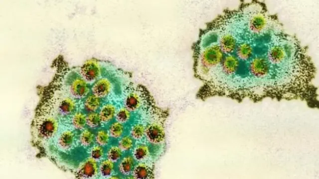 Norovirus