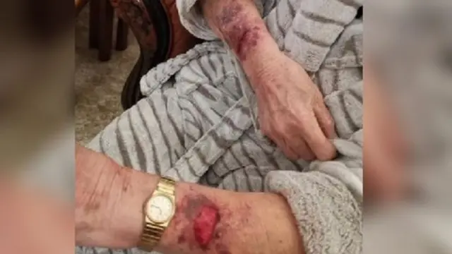 IMAGE OF WOMAN'S INJURIES