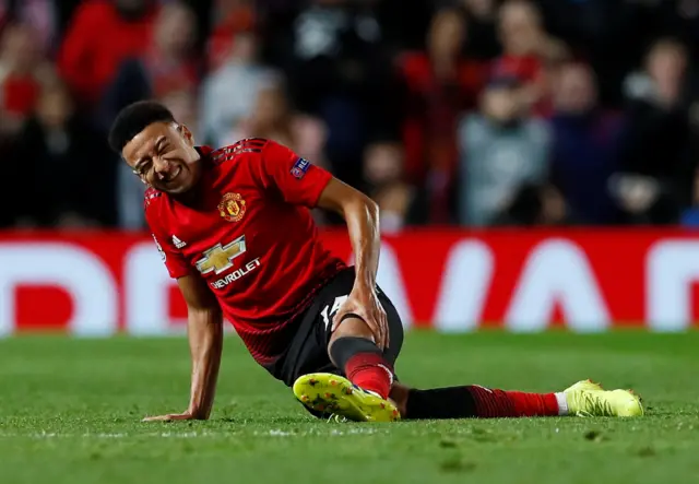 Jesse Lingard inured