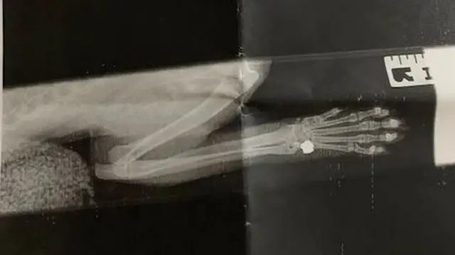 X-Ray of Monty's leg