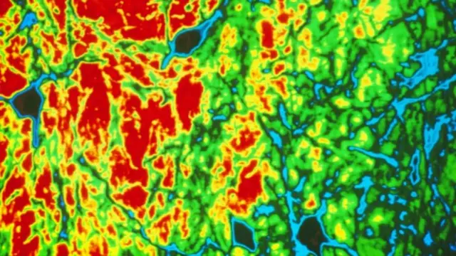 Enhanced light micrograph of brain cells in Parkinsons disease