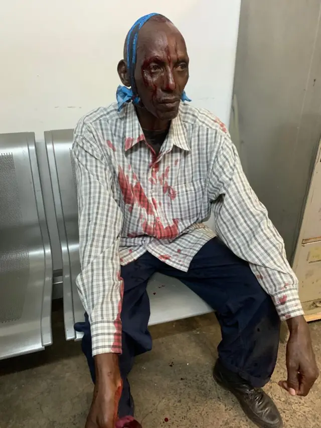 Injured man at airport