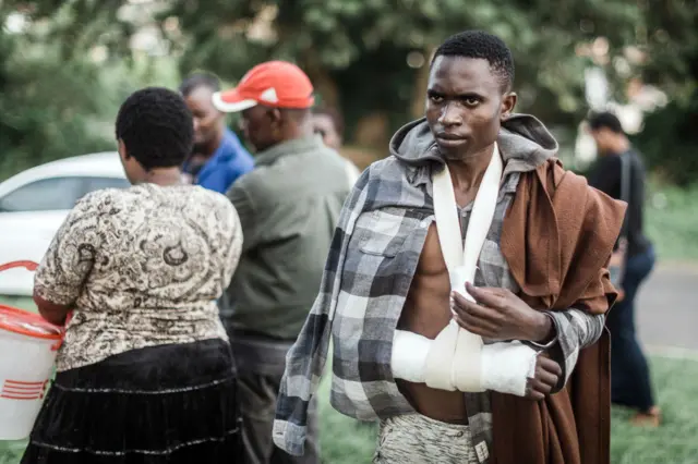 Barnard Hamis from Malawi takes shelter outside a local park near the Sydenham Police Station with his right arm injured soon after surviving an attack on foreign nationals during xenophobic attacks in Durban on March 27, 2019 following violence against immigrants and other foreigners.