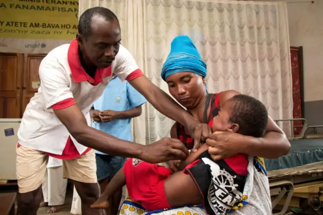 In this photograph taken on February 27, 2019, a Malagasy child is inoculated with Measles Vaccine during a measles epidemic, at a Basic Health Centre Level 2 (CSB 2) in the village of Anivorano, North Antsiranana on the outskirts of Antsiranana.