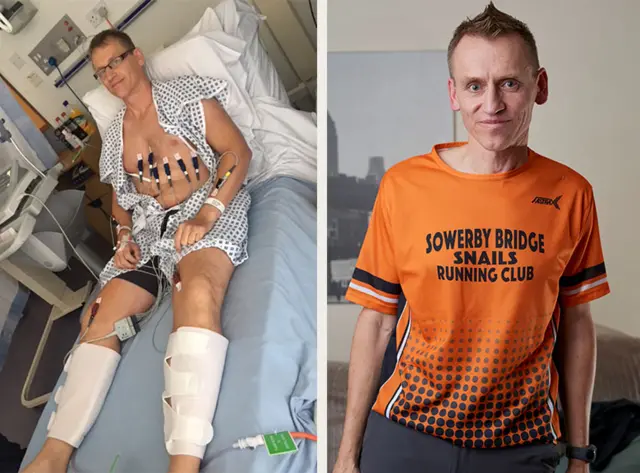 Split image of Gary on a hospital bed and in his running kit