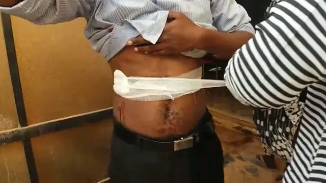 A Sudanese man has a stomach wound dressed with a medical bandage.