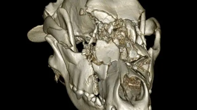 CT scan of injuries