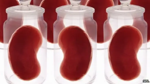 organs in jars