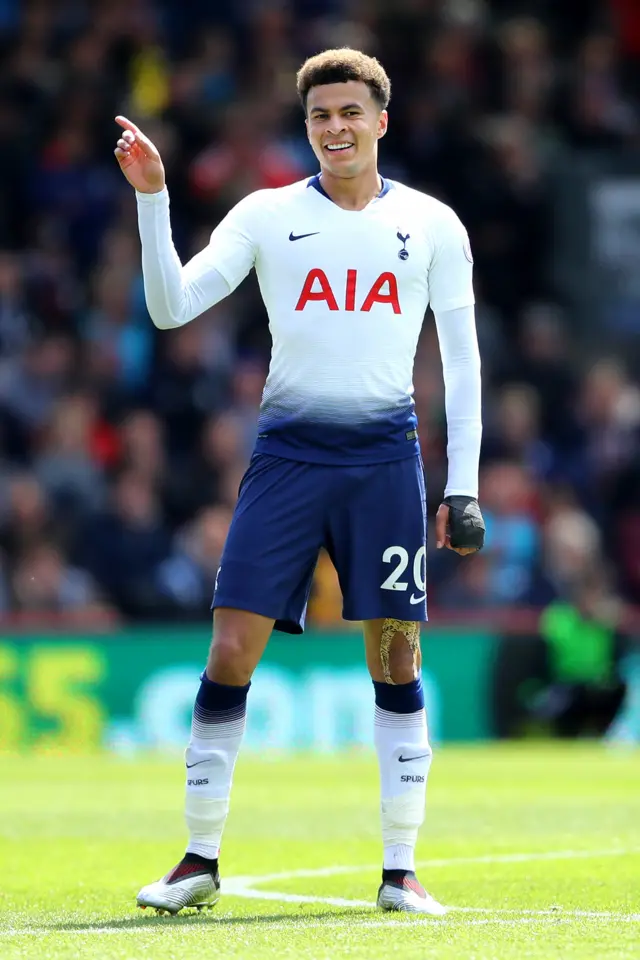 Dele Alli