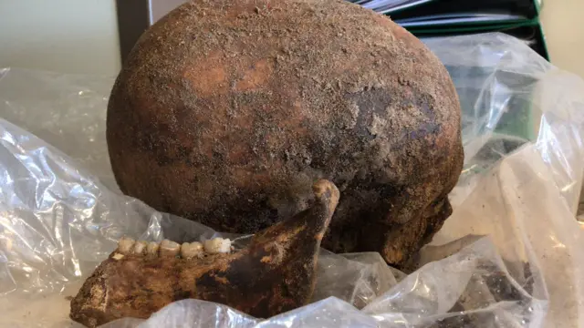 Skull
