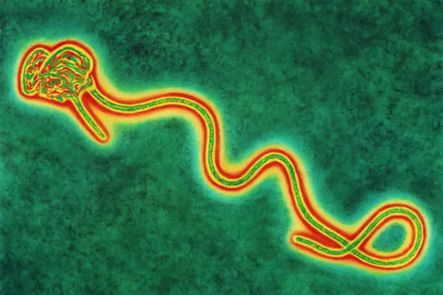 A coloured transmission electron micro-graph of a single Ebola virus.