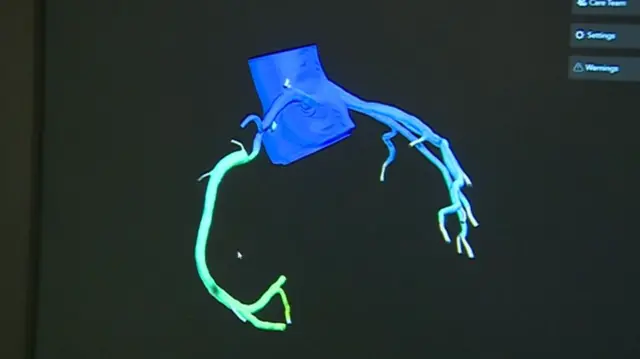 3D scan