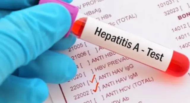 Hep A test