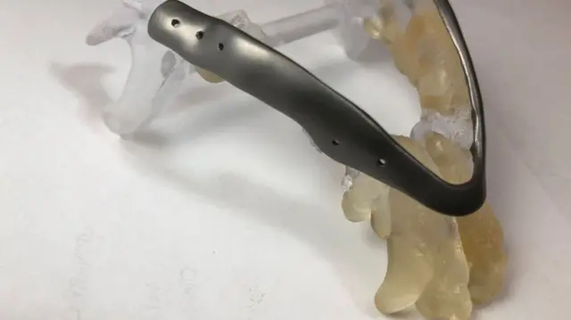 A 3D-printed jaw