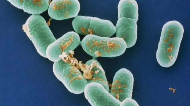 Listeria under a microscope