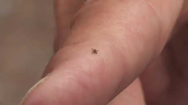 Tick on hand