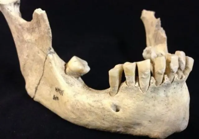 Human jaw and teeth