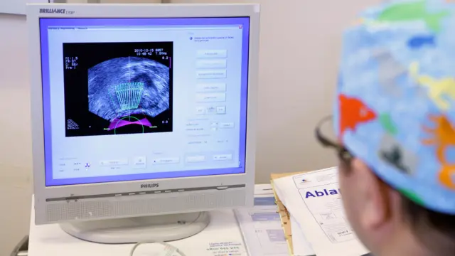 A person looking at a scan