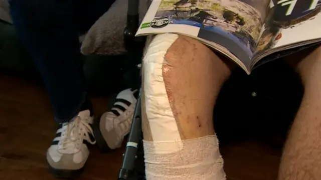 Bandages on Kai's leg after surgery