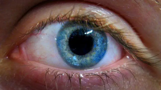 Eye