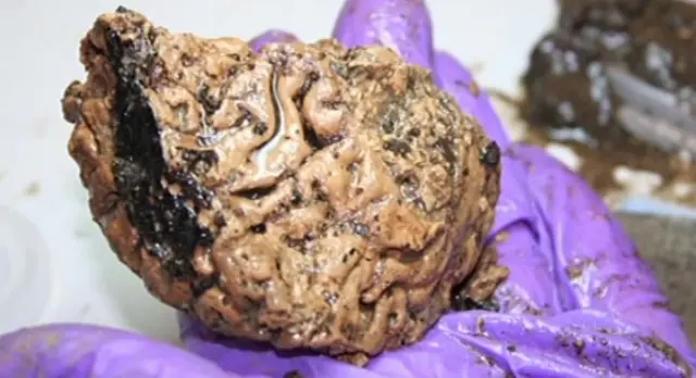 2,500-year-old-brain