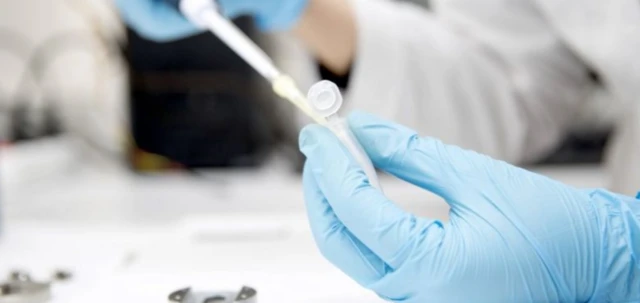 Lab-testing. File photo