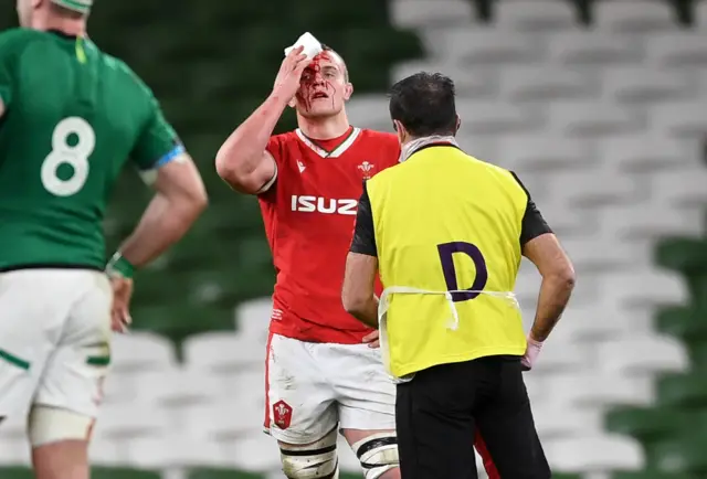 Shane Lewis-Hughes of Wales has a cut seen to by medical staff