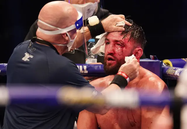 Hughie Fury
