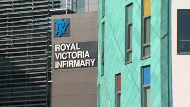 RVI