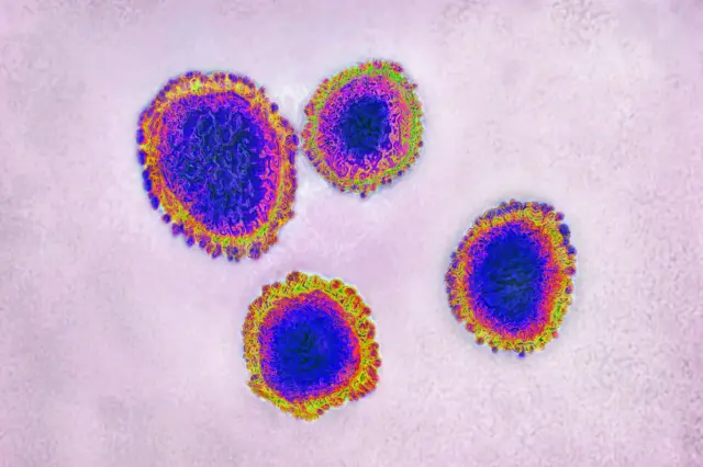 A colour-enhanced view of a coronavirus under a microscope