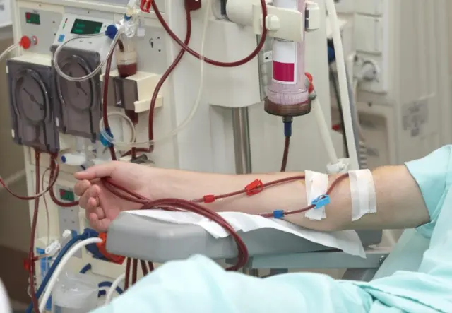 Patient having dialysis treatment