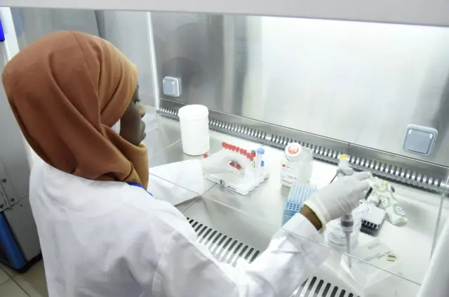 Senegal has coronavirus testing facilities