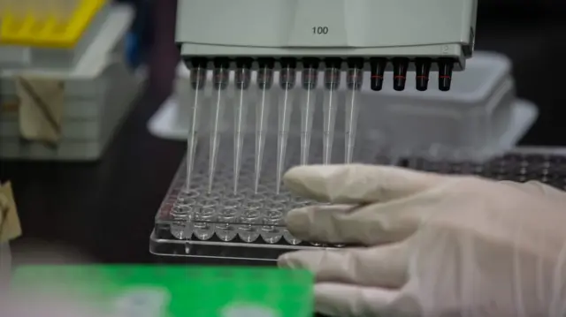 A lab techician works on a neutralising antibody test relating to the new coronavirus at the International Vaccine Institute (IVI) in Seoul